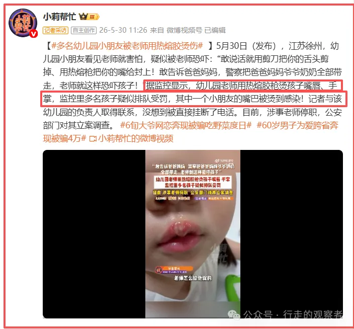 令人发指：小朋友被幼儿园老师用热熔胶烫嘴虐待，其他老师未制止
