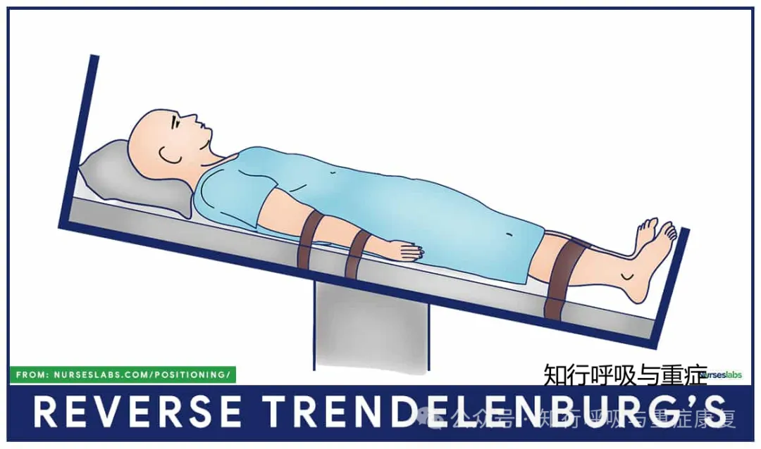 第241期 体位变化对重症患者腹内压的影响