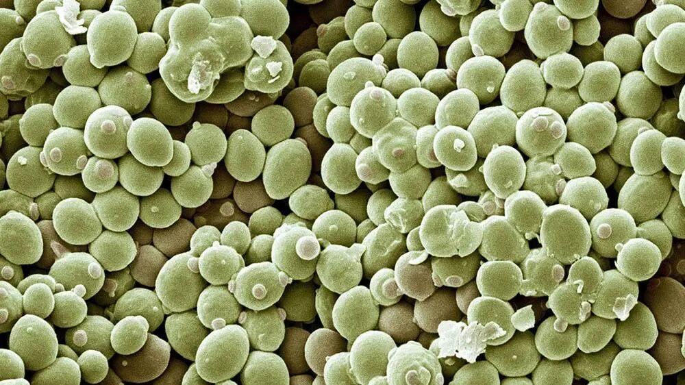 酵母是人造的还是天生的？答案藏在你脚下的土里