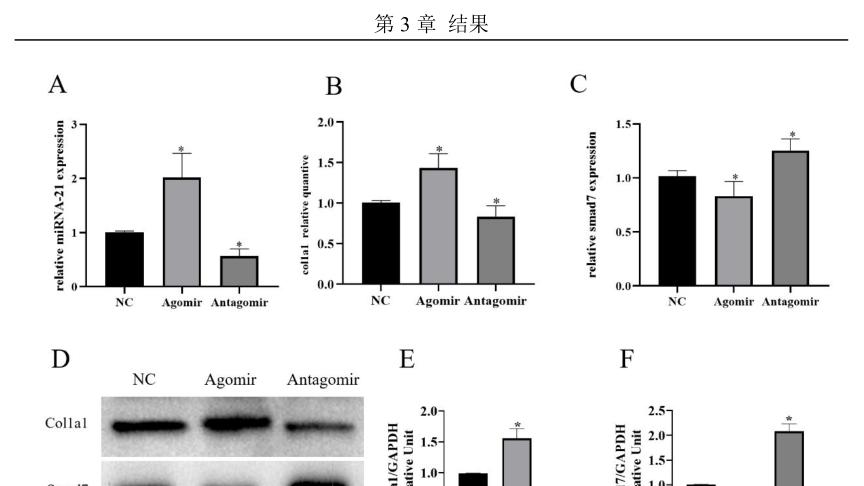 南昌大学使用RFectPM原代细胞siRNA/miRNA转染试剂成功转染大鼠原代膀胱成纤维细胞