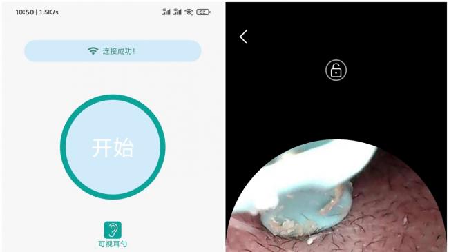儿童怎么掏耳朵？怎么给小孩掏耳屎？儿童掏耳朵神器推荐2026
