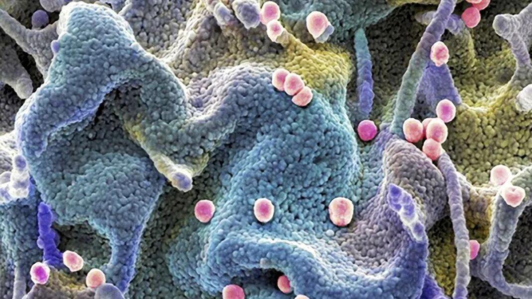 全球11 人实现 HIV 治愈后，科学家终于找到这个让病毒 “自爆” 的新策略，为治愈带来了新希望