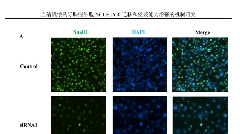深圳大学使用RFect siRNA转染试剂成功转染肺癌细胞NCI-H1650