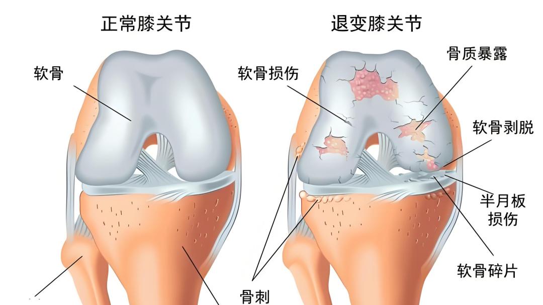 干细胞外泌体：为关节损伤修复带来新突破