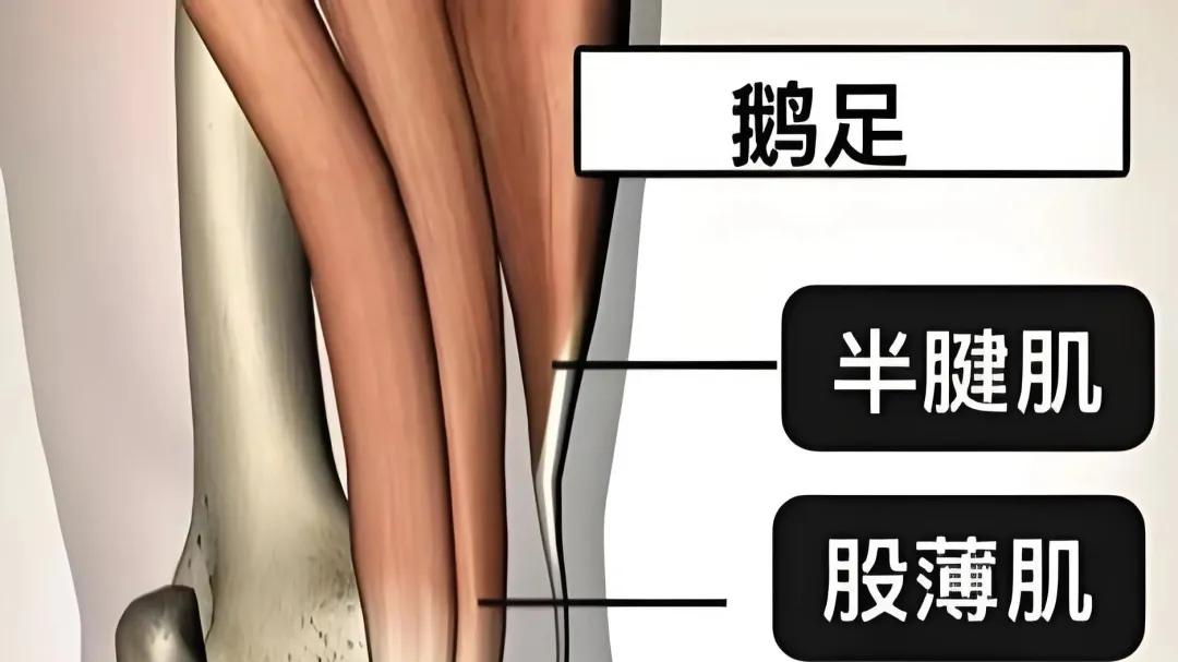 有一种膝内侧疼痛，叫鹅足滑囊炎