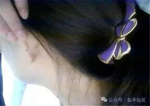 耳朵上有痣好吗 耳朵上有痣表示什么