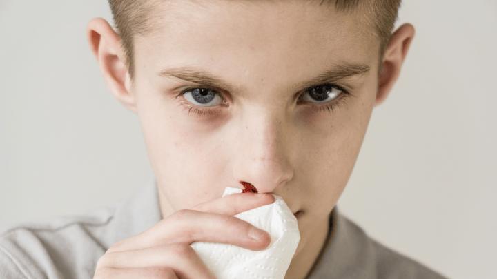 冬季鼻出血频发，别拿它不当回事——掌握鼻出血正确处理方法