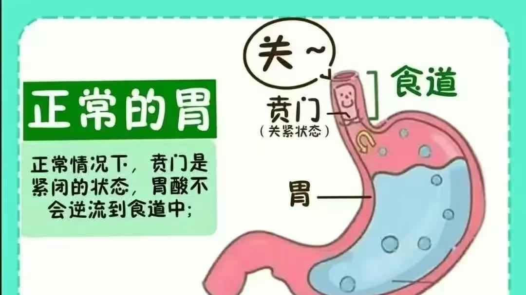 宝宝为什么容易吐奶？可能是他在“自我保护”