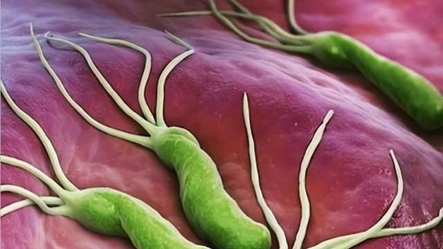 全球50%以上都感染过幽门螺杆菌，一人感染全家排查，早期可治愈