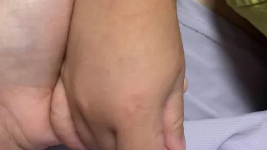 “6月29日才能返校”！不少娃中招！这个疾病近期高发