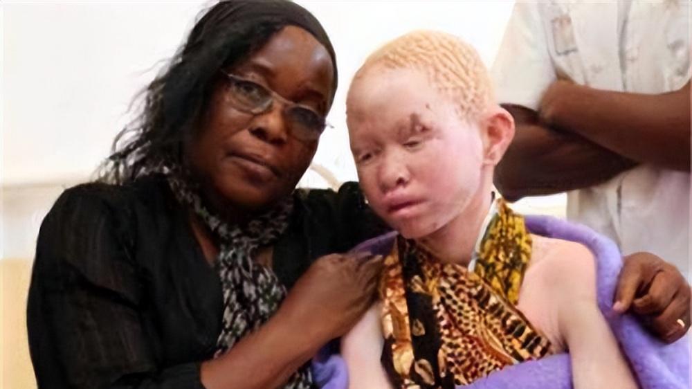 非洲最“精贵”的人，血液比钻石还贵，警察每天24小时贴身保护