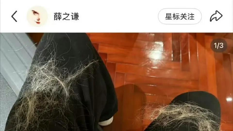 薛之谦自曝满头斑秃+水泡，为舞台硬扛一周不洗头，真相太好哭