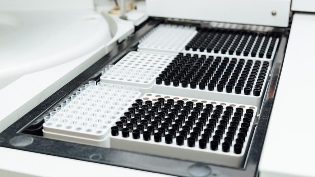 《实验室要买气相色谱？别急！先搞清楚这5个关键问题再掏钱》