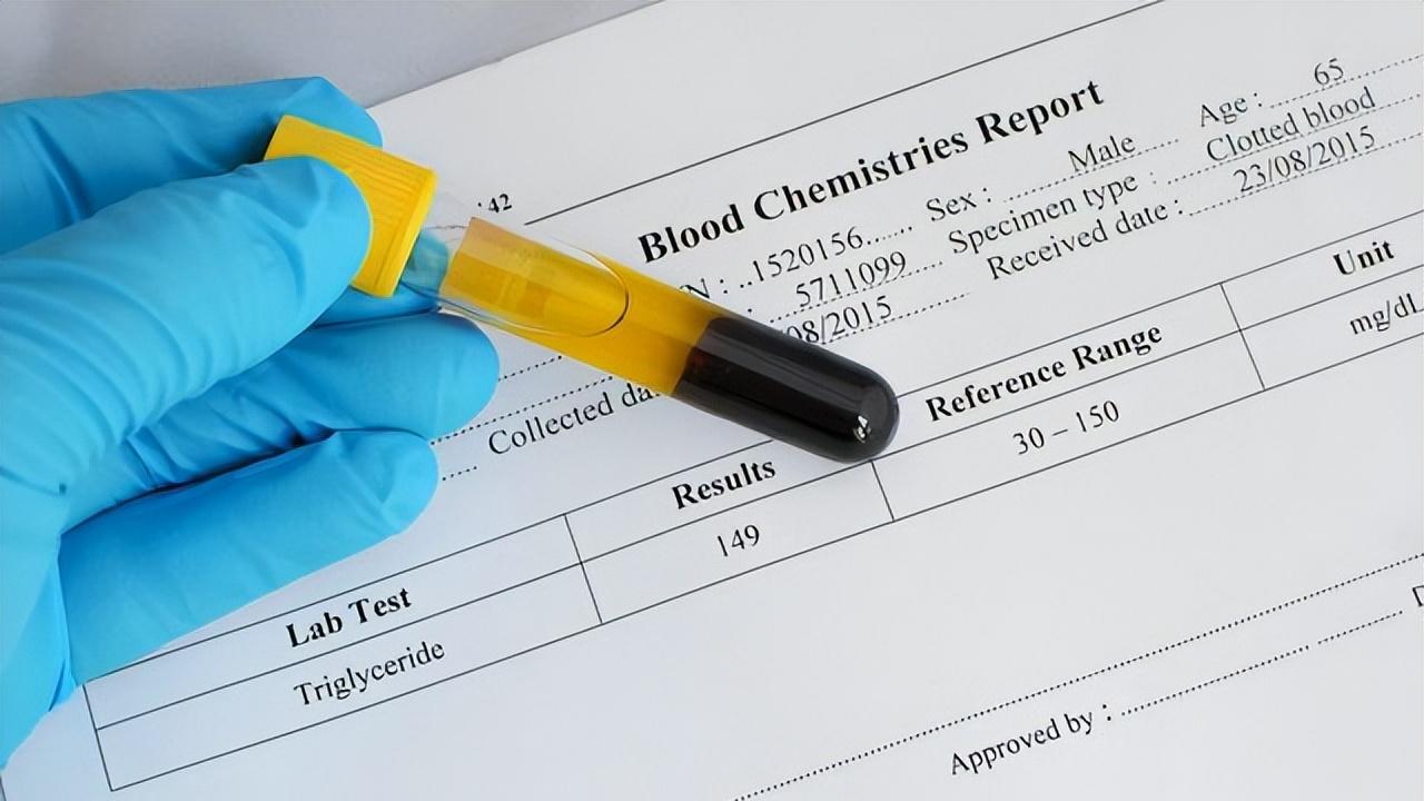 新版血脂检验报告单改版了，应该如何看自己的报告单？要了解一二