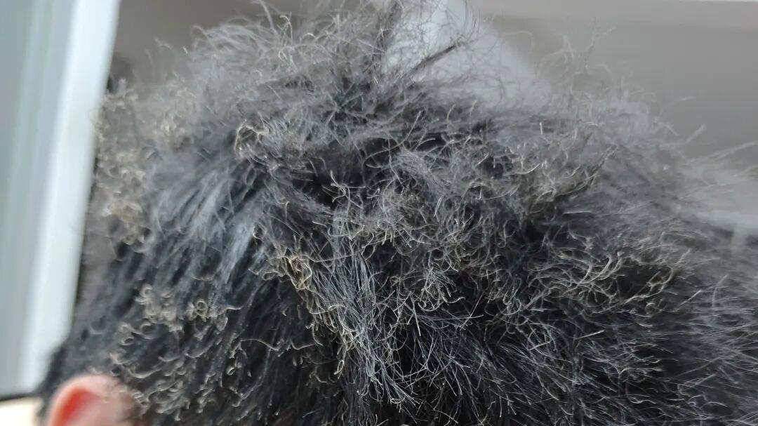 “免费烟花烫，值了！”他笑了，网友心疼了……