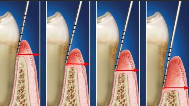 天天刷牙，口臭却越来越重？问题可能不在牙膏，而在这里……