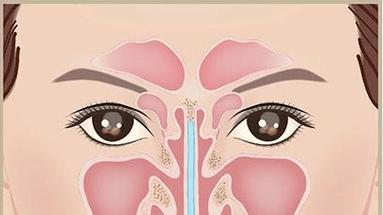 别让鼻子“堵死”你的健康！当心鼻甲肥大在“作祟”~