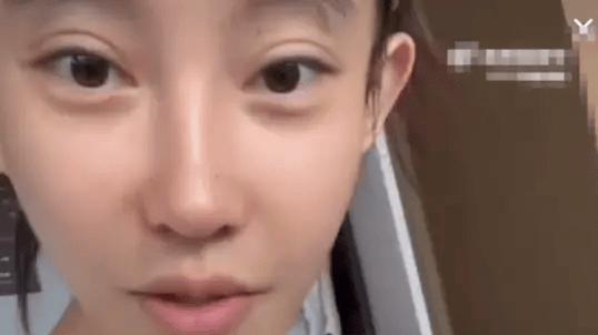 冯提莫瘦50斤露松弛肚皮！澄清非妊娠纹，反怼身材焦虑