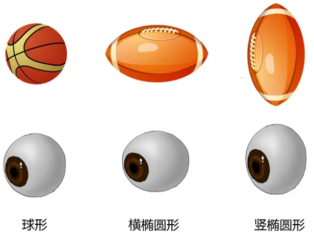 为什么双非镜片更适合散光？看完这篇就懂了
