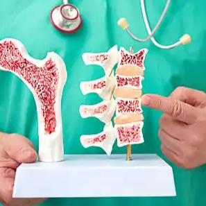 裴姐：强烈建议骨质疏松的人多运动！  很