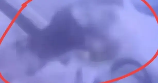 太揪心！女童摸狗被扑咬，紧急送医救治，网友：家长真的要看好