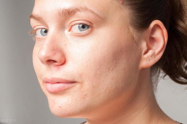 爱吸烟的人，脸部出现 3 种“异常”，说明肺部已被香烟伤害