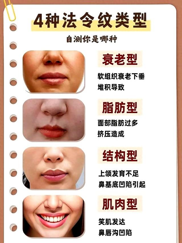 法令纹自救指南！4种类型对应解决办法