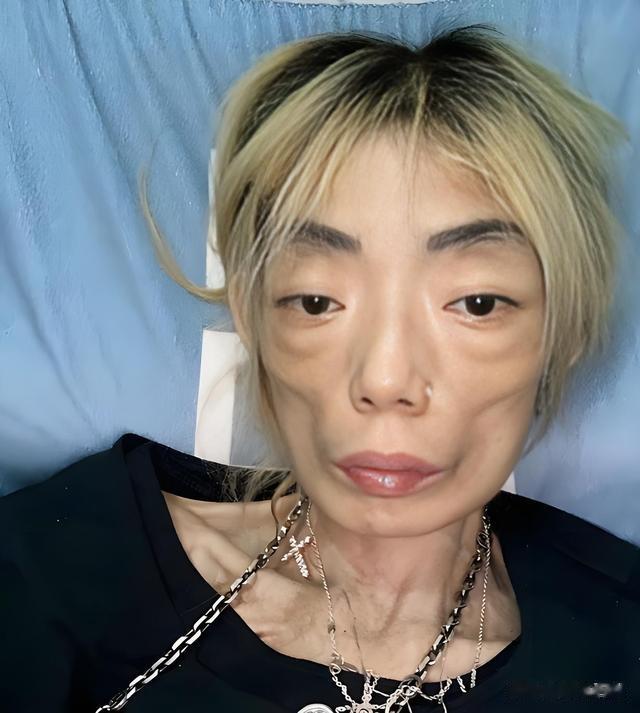 别再盲目追求瘦！这6位明星血泪教训：减肥过度有多可怕？