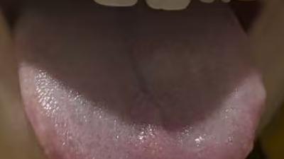 正能量的刘医生：固摄失司？中医辨证调理改