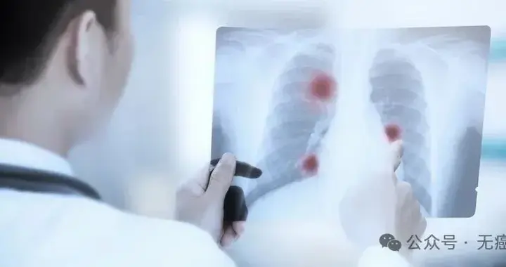 奥希替尼耐药不用怕！查出MET扩增，新型联合方案让生存期翻倍！
