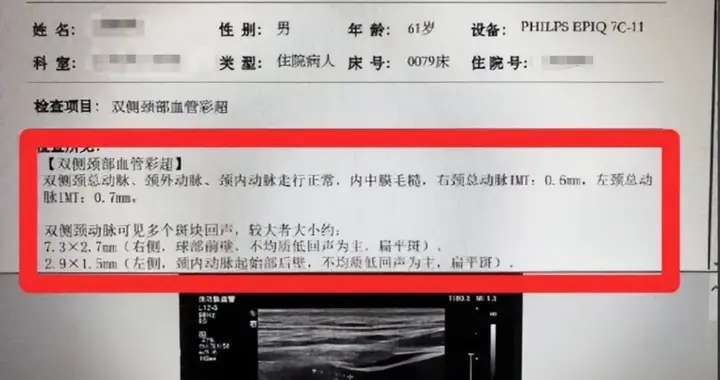 医生：颈动脉斑块没超过这个“厚度”，大多不用吃他汀，别吓自己