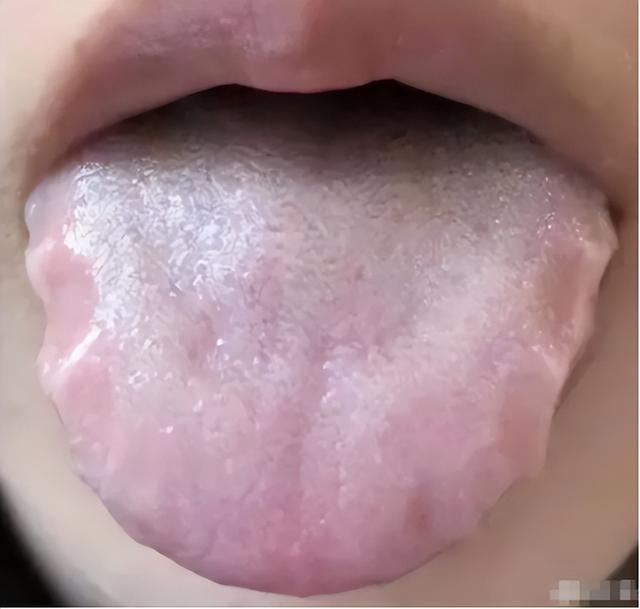 平时不吃寒的，为什么还会脾胃虚寒？其实就是这两处“火”太小了