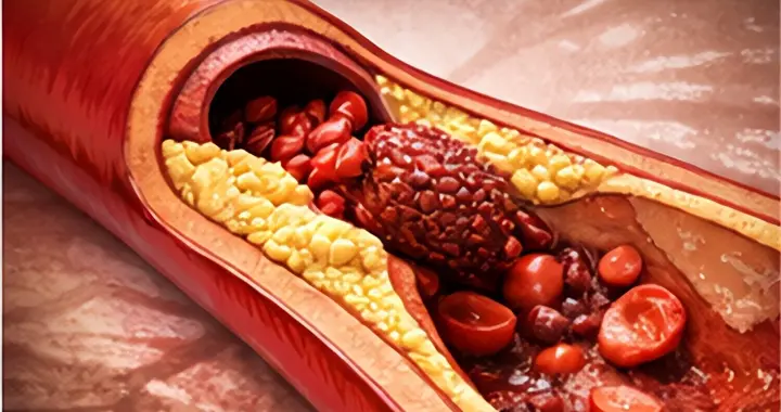 男子凌晨突发心梗离世！医生直言：睡前少做3件事，危害大