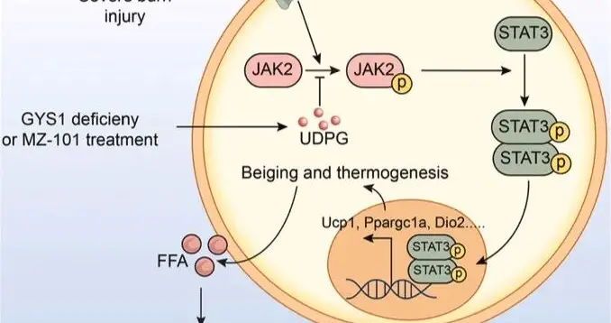 科研人员找到烧伤后的代谢失控“刹车” | 科技前线