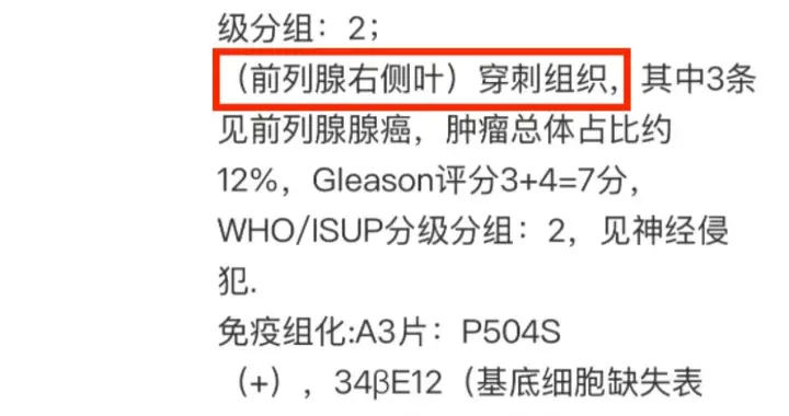 60岁前列腺癌术后2个月，骨转移——病理报告解读