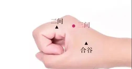 麒麟针开阖枢理论偏头痛针刺治愈病案