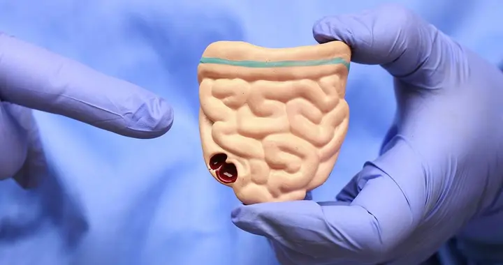 警惕肠癌找上门无征兆，身体有提示！3 排便信号，肠道已出现异常