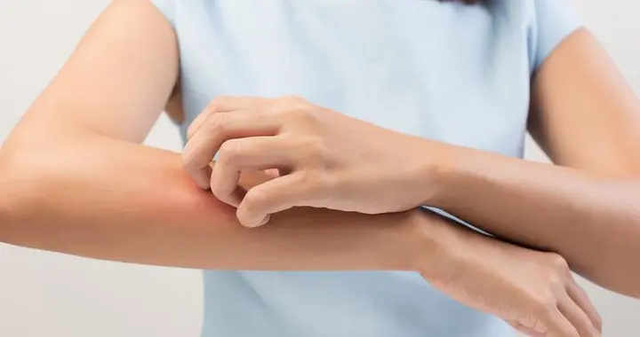 痒是反映身体健康的一面镜子！医生：若频繁发痒，要排查3种疾病