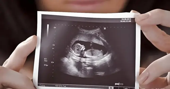 三次流产查完免疫还查啥？这个隐蔽元凶你肯定想不到！附解决方案