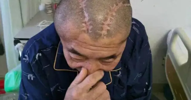 一个小小的手术，竟然让一个家庭的生活陷入了无尽的阴影