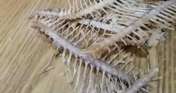 突然鱼刺卡喉，千万别再吞饭、喝醋了！一篇教你正确的处理方法