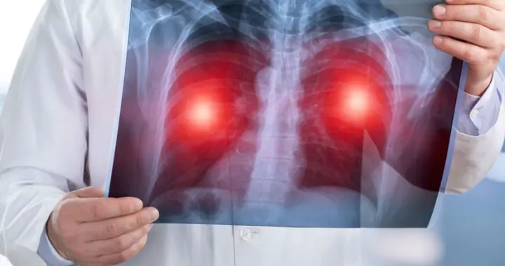 做胸部CT检查时，这5个要点请记住，结果才能可靠