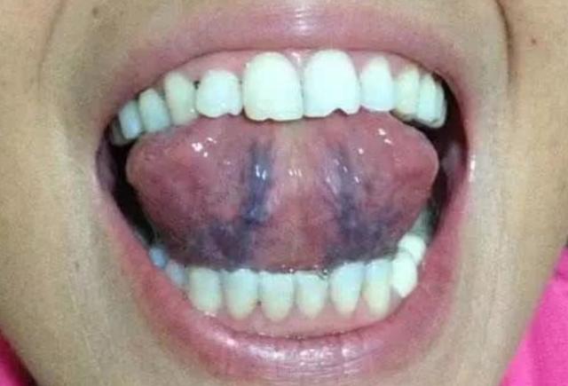 化瘀先理气，理气先疏肝！一招疏肝理气，通经脉淤堵，屡试屡效！