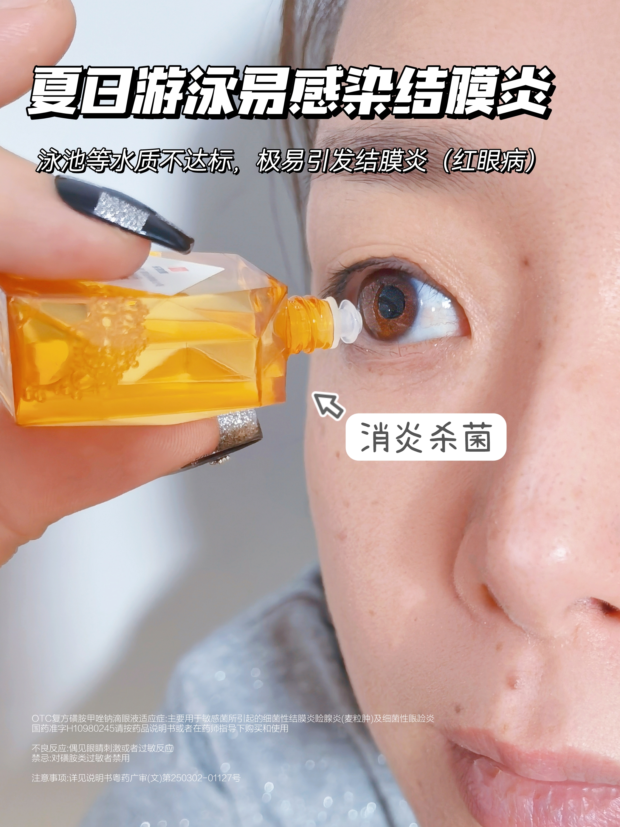 夏日游泳🏊🏻‍♀易感染结膜炎❓