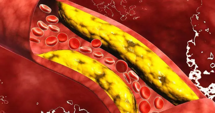 体检单上的血脂6项，到底哪个高了是很危险的？全文看完秒懂
