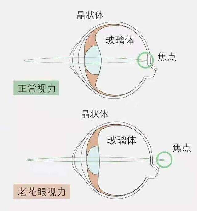 中老年人如何延缓老花眼的出现？上海眼科院长：可以从这几点入手