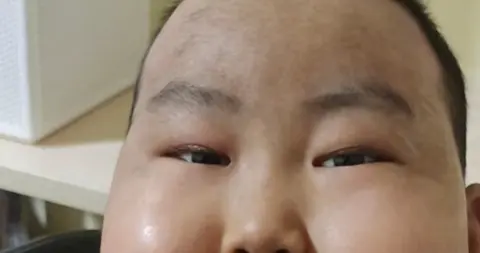 10岁抗癌小王子豪豪去世，在昏睡中告别了这个世界，妈妈崩溃