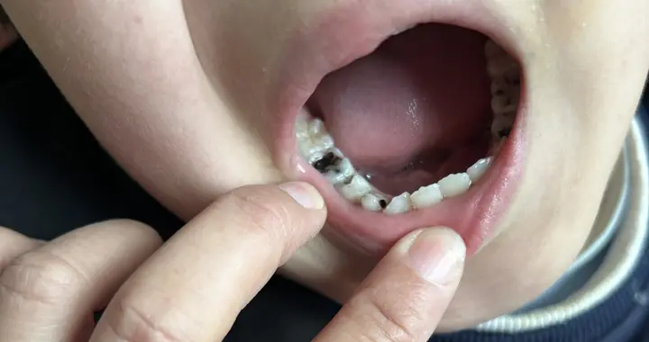 自费3K横评6款儿童牙刷，谁是真香机？到底谁坑娃？