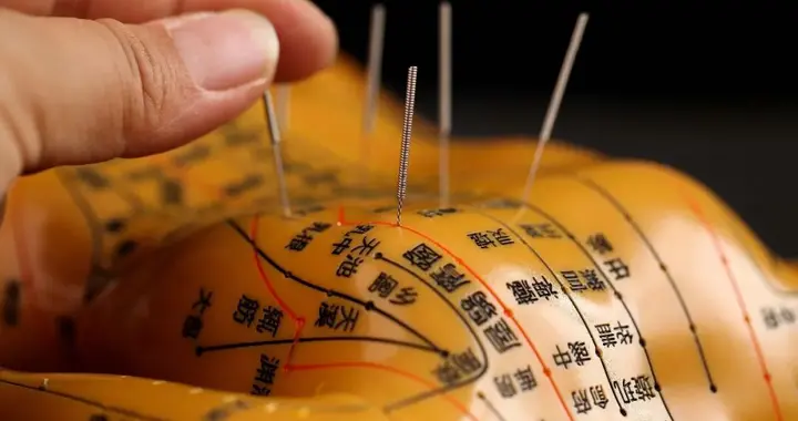 常说针灸立竿见影，为什么这么神奇？