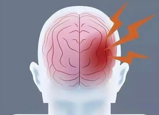 活血化瘀的“利器”是它们，家里有脑梗患者或想要防御，不妨看看